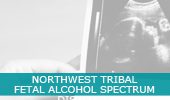 northwest tribal fetal alcohol spectrum information header